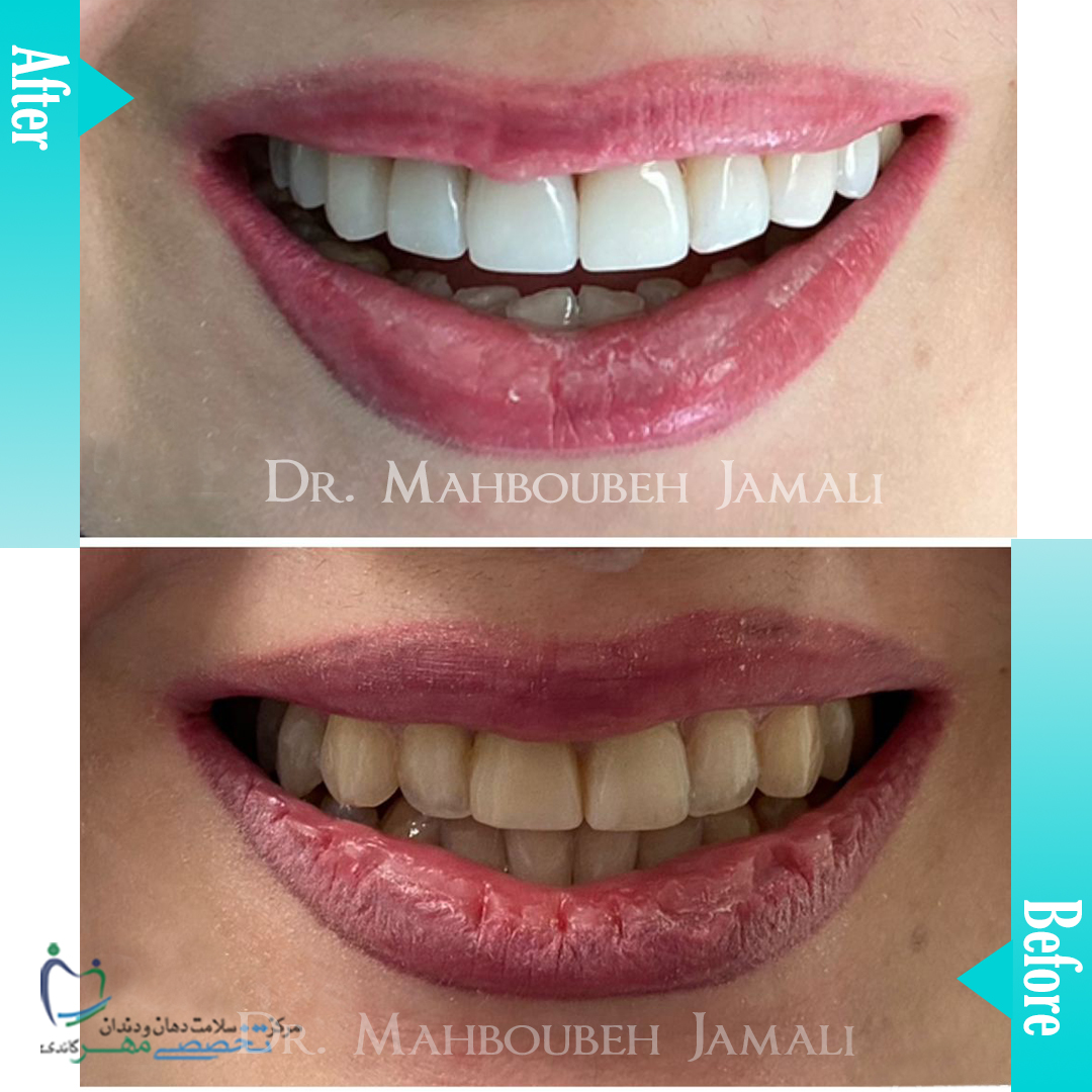 دکتر محبوبه جمالی - متخصص ترميمی و زیبایی (کامپوزیت ونیر / لمینیت کامپوزیتی)