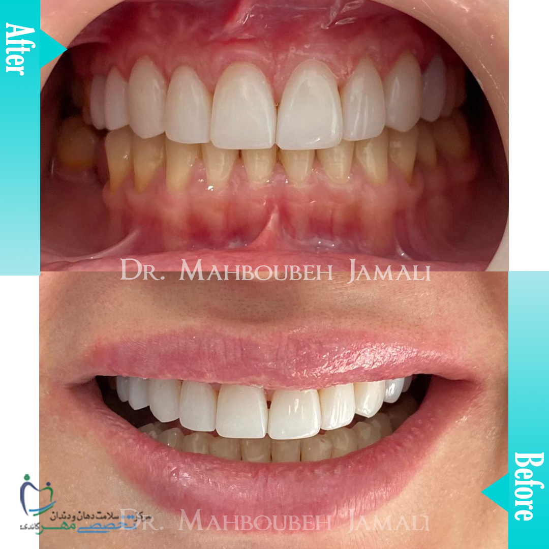 دکتر محبوبه جمالی - متخصص ترميمی و زیبایی (کامپوزیت ونیر / لمینیت کامپوزیتی)